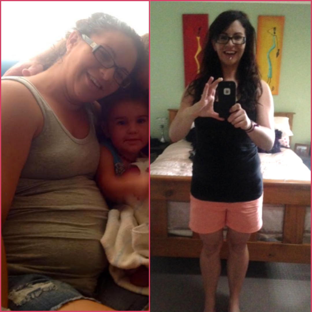 Antes e depois de Tereza